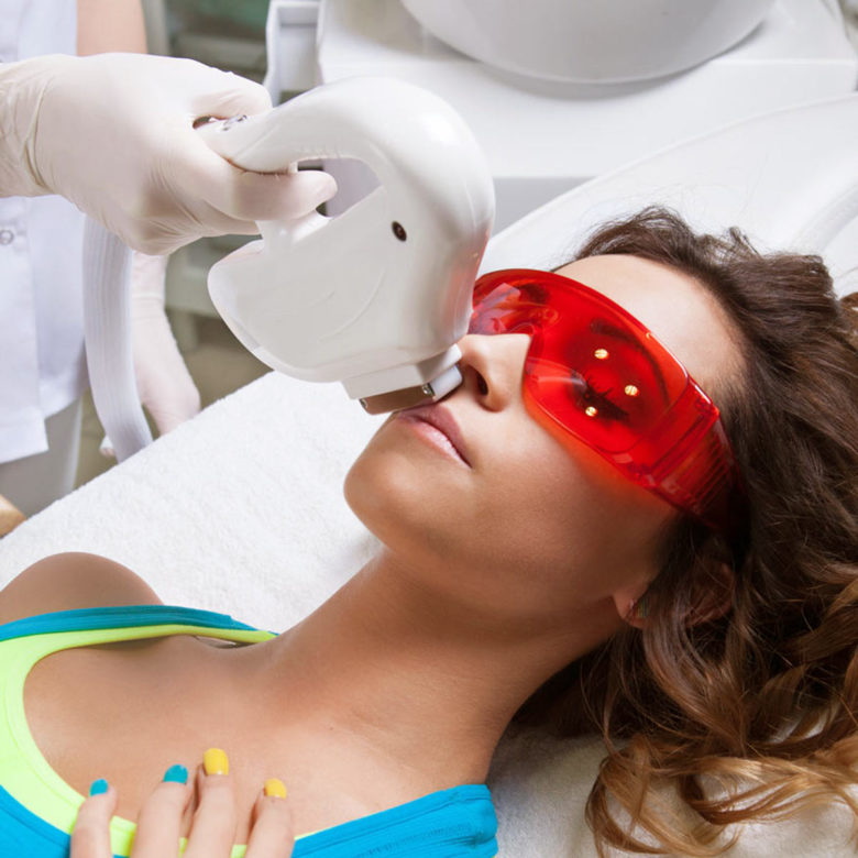 A young woman lies on a treatment table and receives a laser hair removal treatment to her upper lip.