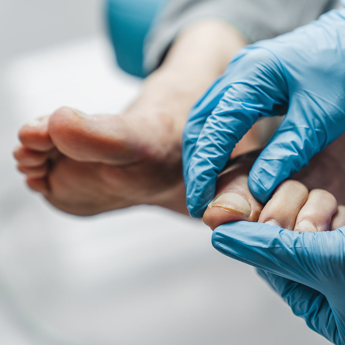 A nurse's gloved hands hold a foot to better examine the toenail.