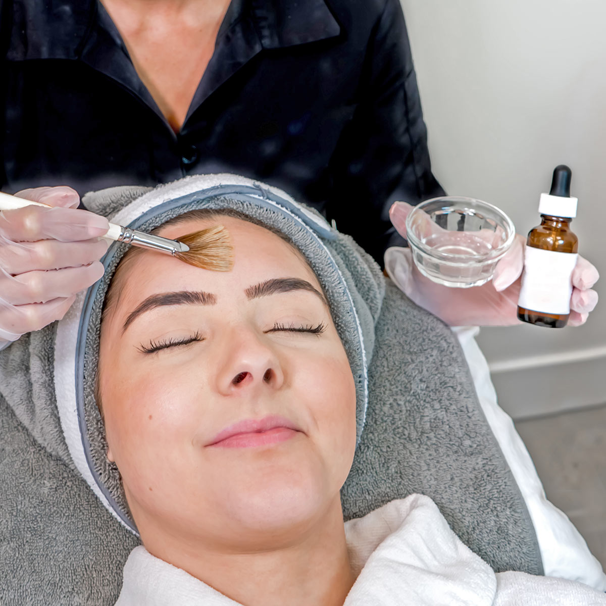 A woman with a towel around her head receives a chemical peel treatment to her face from an esthetician.