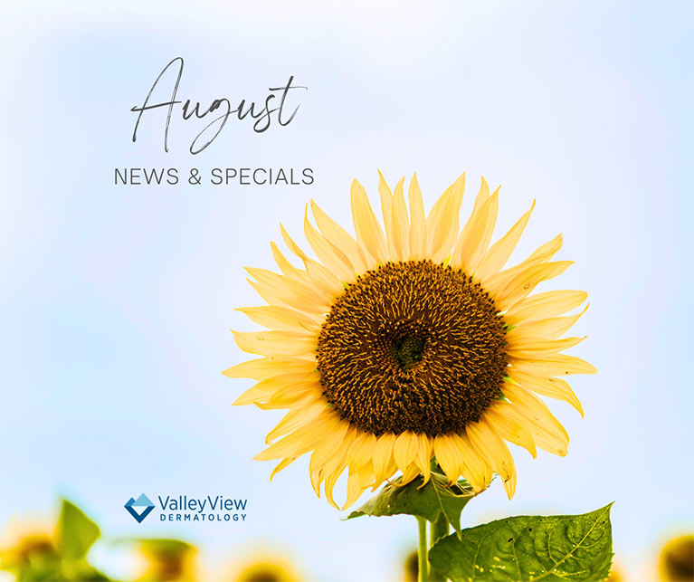 The words "August News and Specials" on a background of a summer sky and sunflowers.
