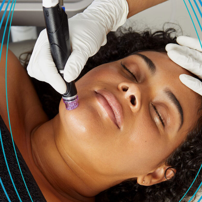 Closeup of a young woman's face as she lies on a treatment table to receive a hydrafacial treatment.