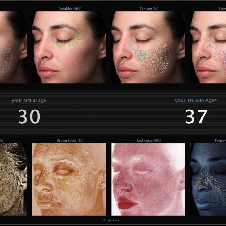 Image of Visia Skin Analysis: a woman's face is seen through multiple filters that show different skin problems.